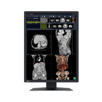 Monitor medicale da refertazione EIZO RX270 + RadiLight Omaggio!