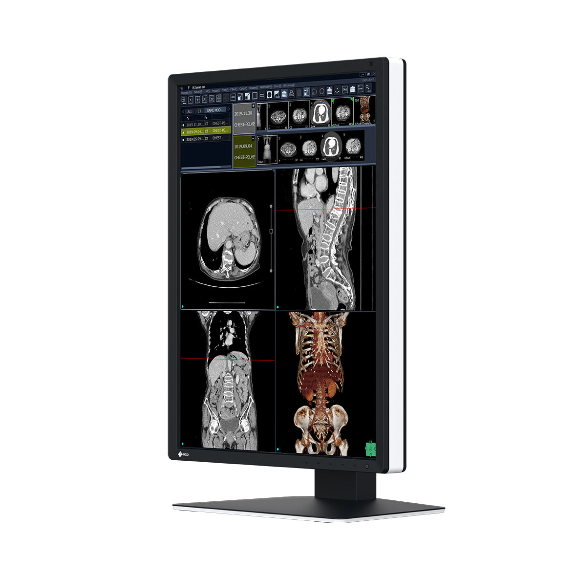 Monitor medicale da refertazione EIZO RX270 + RadiLight Omaggio!