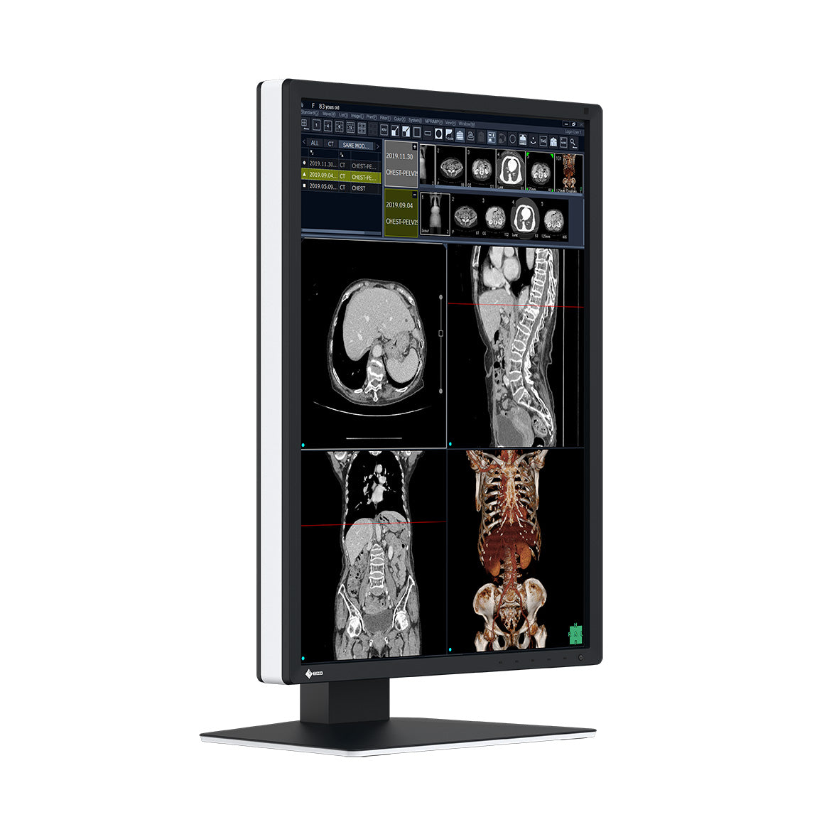 Monitor medicale da refertazione EIZO RX270 + RadiLight Omaggio!