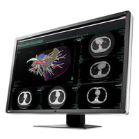 Monitor medicale da refertazione EIZO RX660 + RadiLight Omaggio!