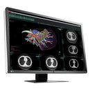 Monitor medicale da refertazione EIZO RX660 + RadiLight Omaggio!