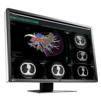 Monitor medicale da refertazione EIZO RX660 + RadiLight Omaggio!