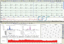 Sistema Holter ECG 24 h GIMA (Software + Registratore)