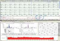 Sistema Holter ECG 24 h GIMA (Software + Registratore)