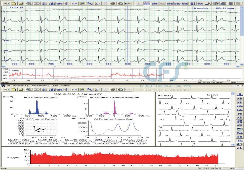 Sistema Holter ECG 24 h GIMA (Software + Registratore)