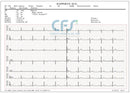 ECG Edan SE-301 Touch - Elettrocardiografo a 3-6 canali Interpretativo