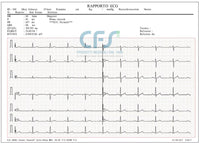 ECG Edan SE-301 Touch - Elettrocardiografo a 3-6 canali Interpretativo