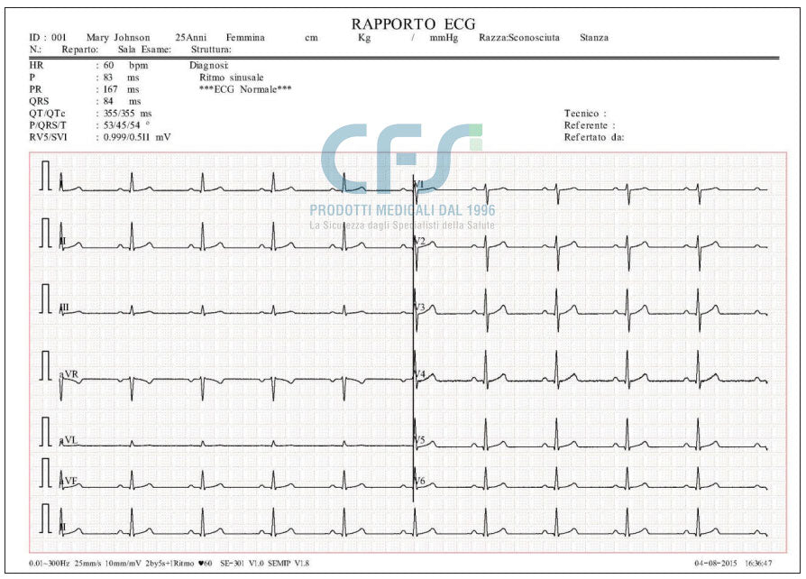 ECG Edan SE-301 Touch - Elettrocardiografo a 3-6 canali Interpretativo