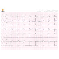 ECG bluetooth D-Heart - 8 canali per Smartphone e Tablet