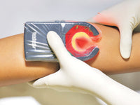 Rilevatore vene portatile VEINSPY