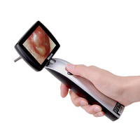 Video Otoscopio MD Scope MS102 - Pack Deluxe con 2 sonde video 47 e 150 mm