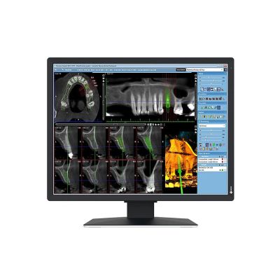 Monitor medicale da consultazione MX217-HB