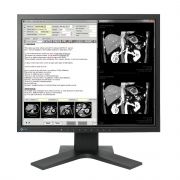 Monitor medicale da consultazione EIZO MX194